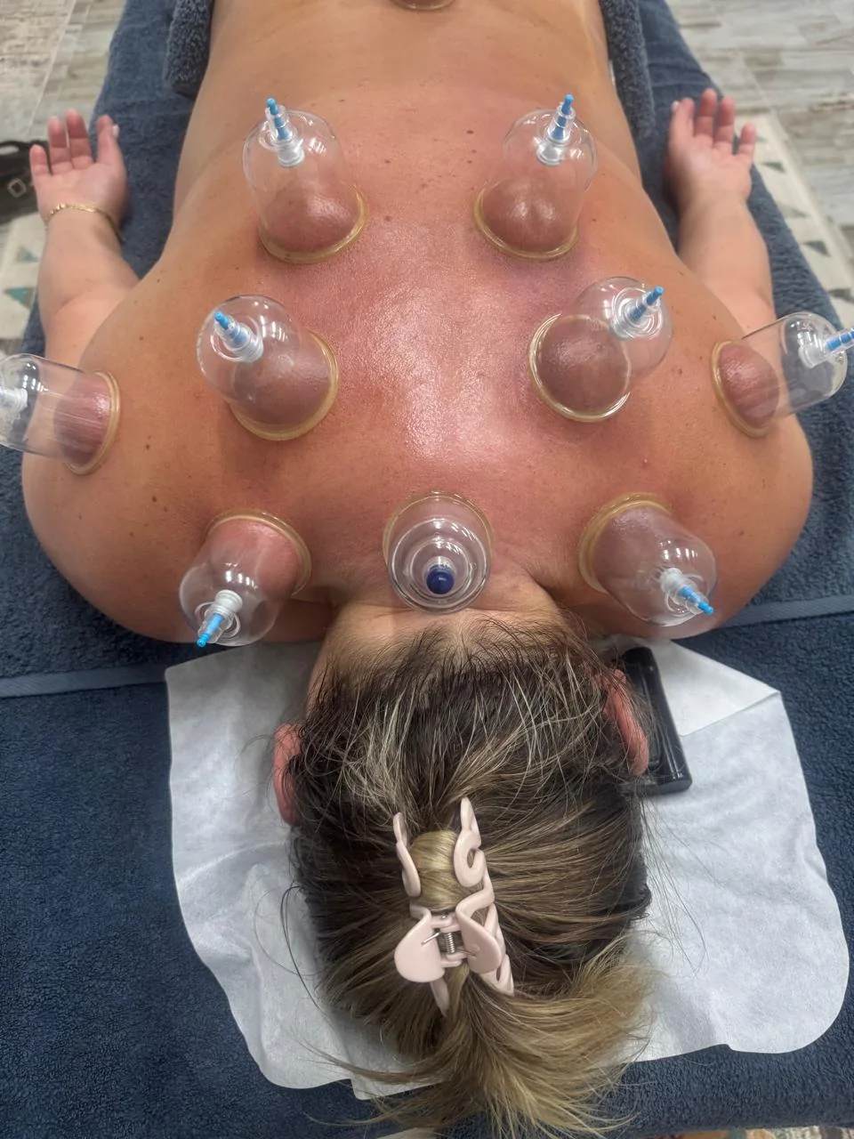 Top view of a cupping session